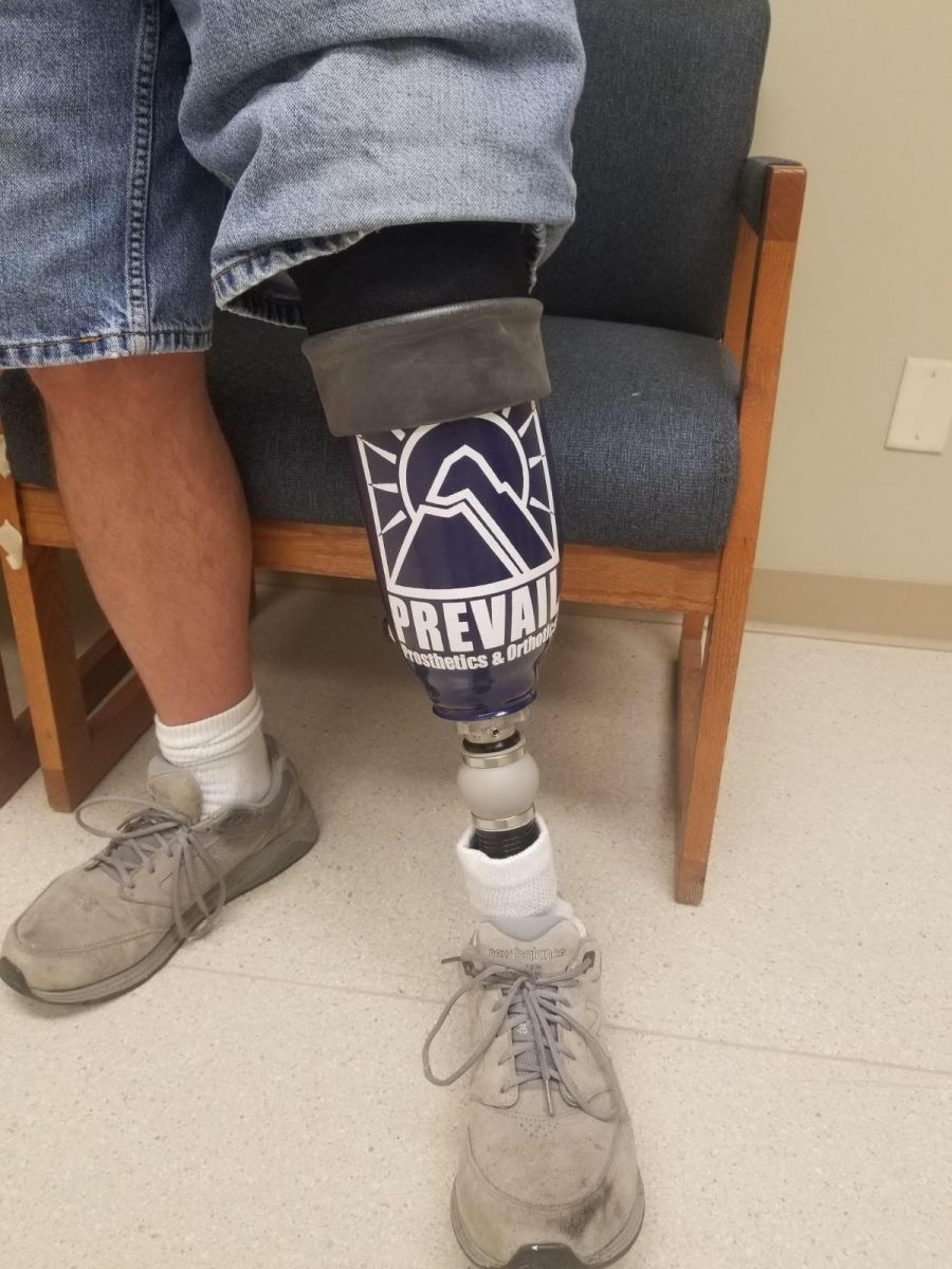 Prevail Prosthetics & Orthotics | Indiana